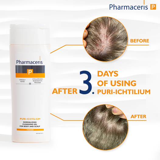 Pharmaceris normalizing cleansing gel fyrir líkama og hársvörð - Image 2